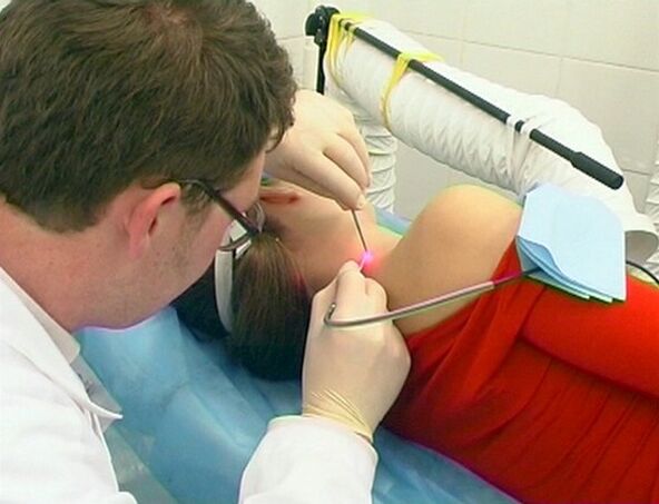 Papilloma removal